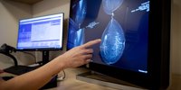 Dutch hospital is one of the first to use AI to detect breast cancer